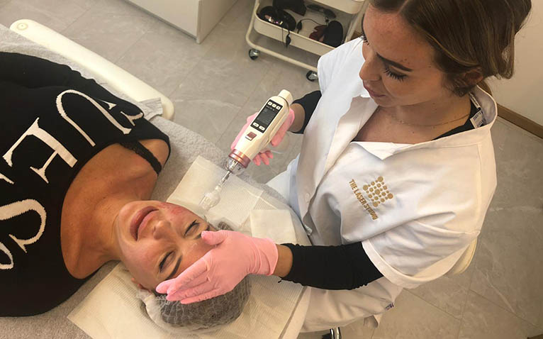 Skinbooster behandeling